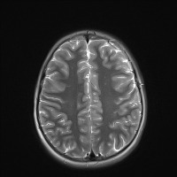 MRI. project thumbnail