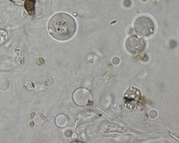 Cladosporium project thumbnail