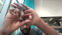 anthracnose project thumbnail