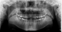 Sistema web dental final project thumbnail