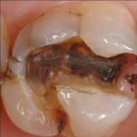 Dental project thumbnail