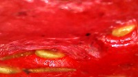 Strawberry Mold Detection project thumbnail