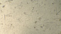 Research on plant parasite detections project thumbnail