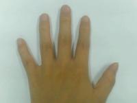 Nail project thumbnail