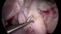 surgical_tool_annotation_3 project thumbnail