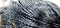 Head lice AI project thumbnail