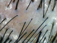 smart brush project thumbnail