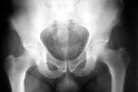 Xray object detection project thumbnail