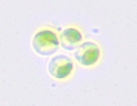 Dictyosphaerium Actinastrum Platymonas Kirchneriella Oocystis project thumbnail