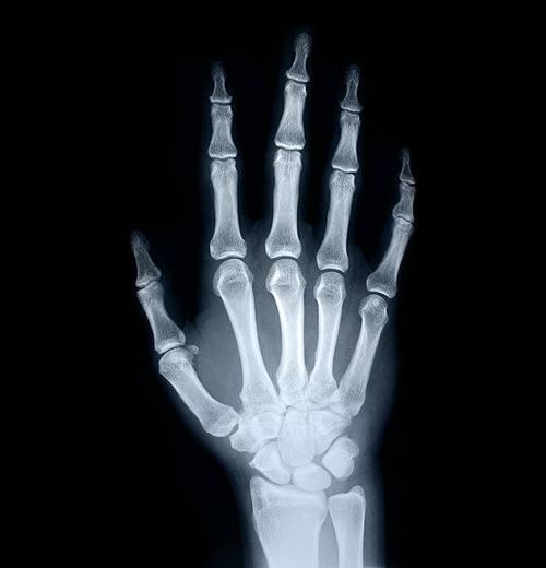 xray classifier Classification Model by UD Course WS