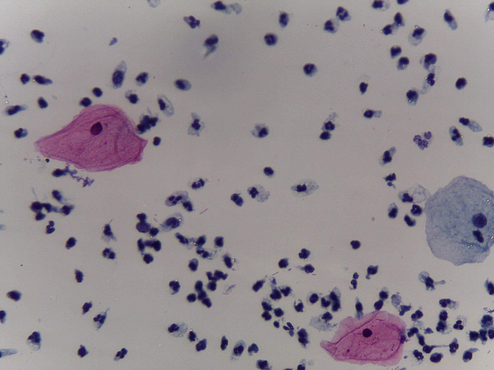 Pap Smear Cell Segmentation Mask Instance Segmentation Dataset by Pap ...