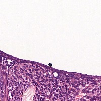 follicle1-2_final project thumbnail