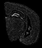 Mouse Brain Segmentation project thumbnail