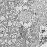 MitoEM_Sperm project thumbnail