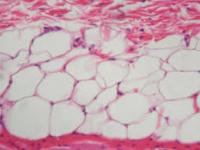 New Dataset project thumbnail