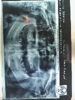 X-ray Classified project thumbnail