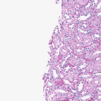 tubules_segmentation project thumbnail