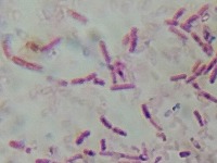 E.coli Detection project thumbnail