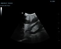 kidney_s01 project thumbnail