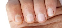 Nail_1 project thumbnail