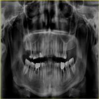 DentiQA project thumbnail