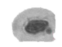 NucleuDetection project thumbnail