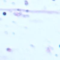 benchmark project thumbnail