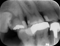 teeth expand dataset project thumbnail