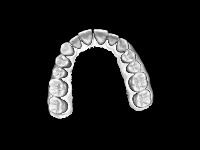 try project thumbnail