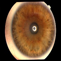 Pupil Segmentation RGB final Instance Segmentation Model by YOLO PFE