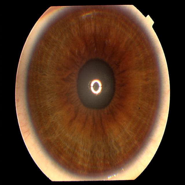 Pupil Detection RGB final Object Detection Dataset and Pre-Trained ...
