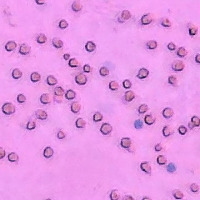 Cell Detection project thumbnail