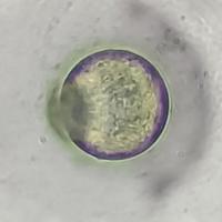 microplastic-detection project thumbnail