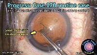 S_CC_2172_progress case 170  project thumbnail