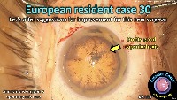 S_CC_2109_european resident  project thumbnail