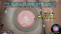 S_CC_2107:good to great cataract project thumbnail