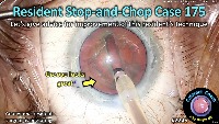 S_CC_2245_resident case 175 project thumbnail