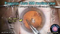 S_CC_2173_progress case 500 project thumbnail