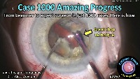 S_CC_2257_case 1000 amazing  project thumbnail