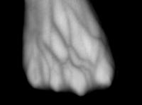 Vein Segmentation6thJune project thumbnail
