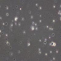 pengenalan sperm-nonsperm 2 project thumbnail