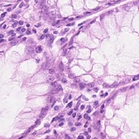Colon project thumbnail