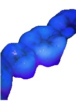Plaque Detection project thumbnail
