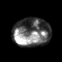 MRI DATA project thumbnail