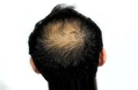 HAIR AND SCALP project thumbnail