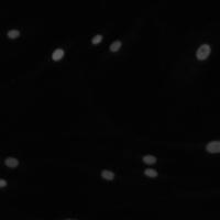 cytonuclei project thumbnail