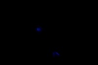 Moonshot Cancer Proliferation project thumbnail
