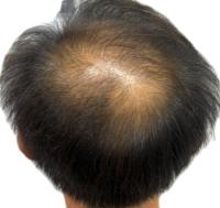 Scalp_Signal project thumbnail
