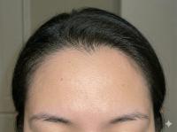 Scalp_Signal_v3(seg) project thumbnail