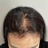 Scalp_Signal_v2 project thumbnail
